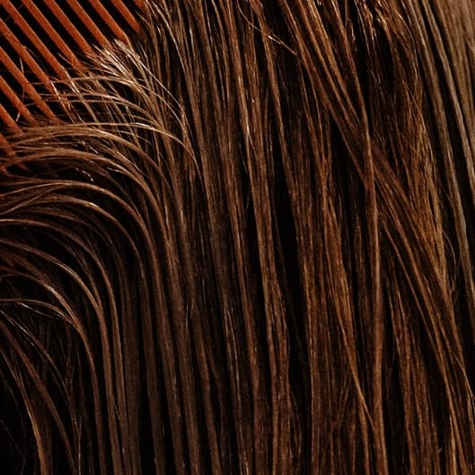 Scalp & Hair Restoration at Phoenix Esthetics in Southington, CT