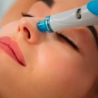 Bronze Hydrafacial Package at Phoenix Esthetics in Southington, CT